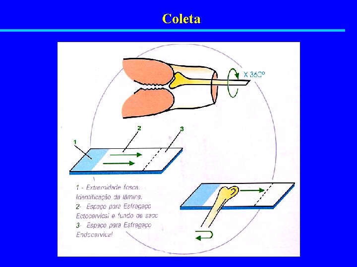 Coleta 