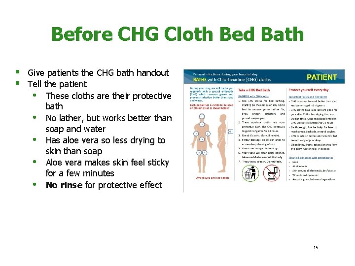 Before CHG Cloth Bed Bath § § Give patients the CHG bath handout Tell