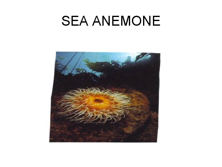 SEA ANEMONE 