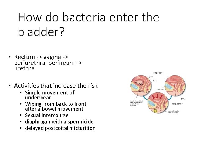 How do bacteria enter the bladder? • Rectum -> vagina -> periurethral perineum ->