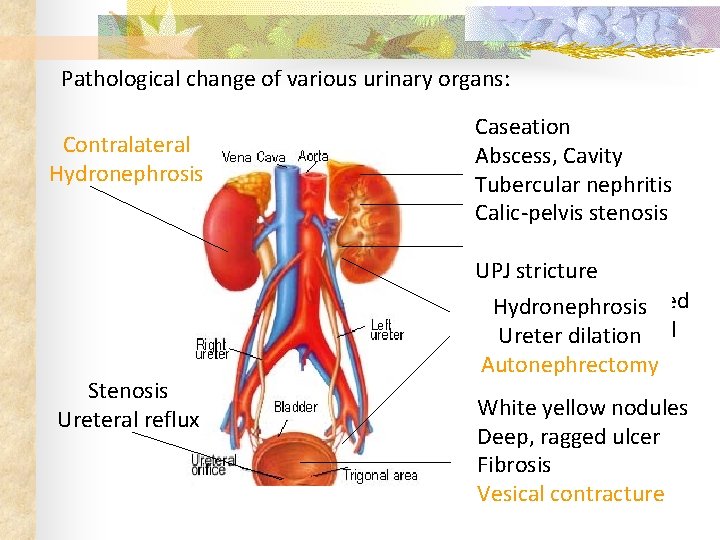 Pathological change of various urinary organs: Contralateral Hydronephrosis Stenosis Ureteral reflux Caseation Abscess, Cavity