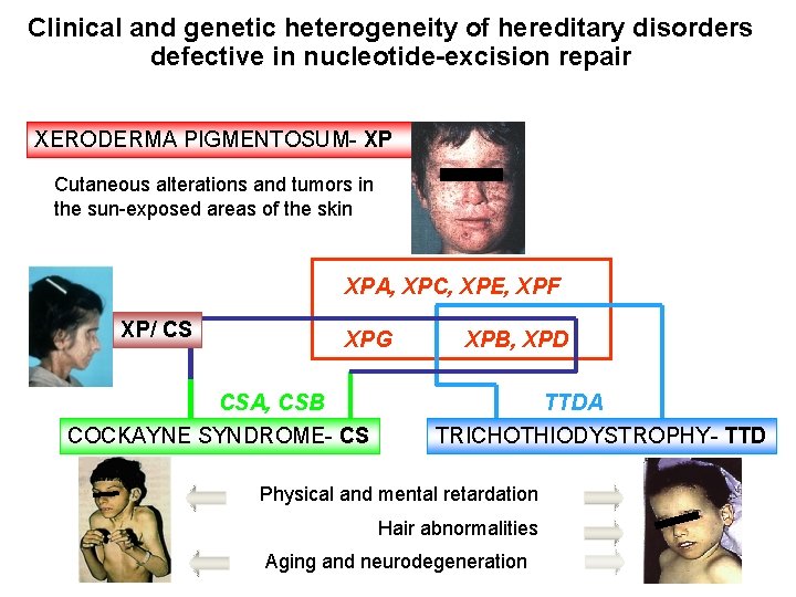 Clinical and genetic heterogeneity of hereditary disorders defective in nucleotide-excision repair XERODERMA PIGMENTOSUM- XP