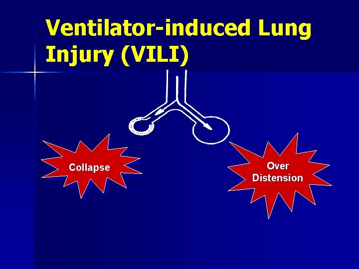 Ventilator-induced Lung Injury (VILI) Collapse Over Distension 