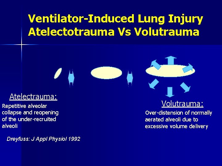 Ventilator-Induced Lung Injury Atelectotrauma Vs Volutrauma Atelectrauma: Repetitive alveolar collapse and reopening of the