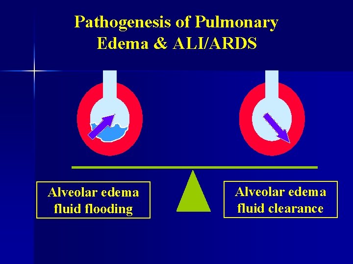Pathogenesis of Pulmonary Edema & ALI/ARDS Alveolar edema fluid flooding Alveolar edema fluid clearance