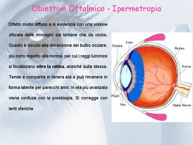 Obiettivo Oftalmico - Ipermetropia Difetto molto diffuso e si evidenzia con una visione sfocata