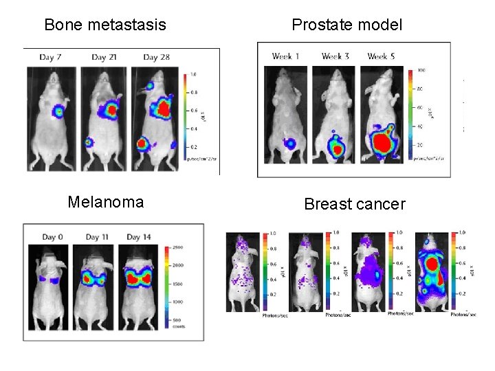 Bone metastasis Melanoma Prostate model Breast cancer 