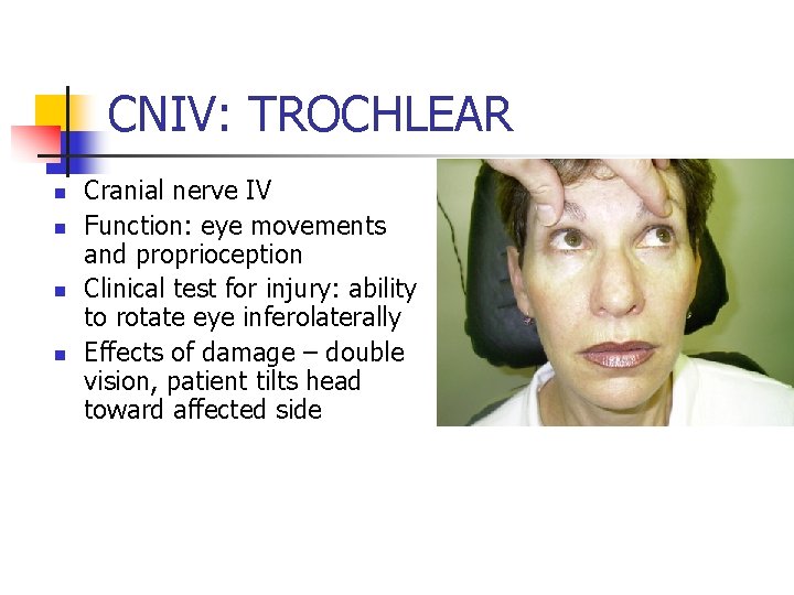 CNIV: TROCHLEAR n n Cranial nerve IV Function: eye movements and proprioception Clinical test