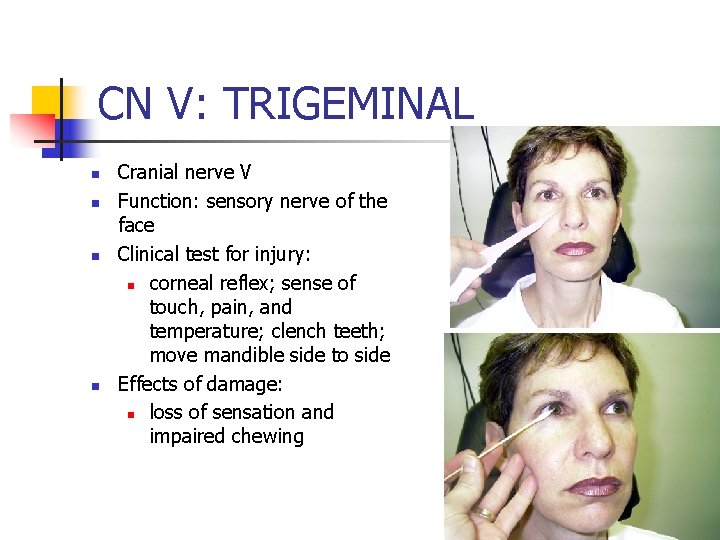 CN V: TRIGEMINAL n n Cranial nerve V Function: sensory nerve of the face