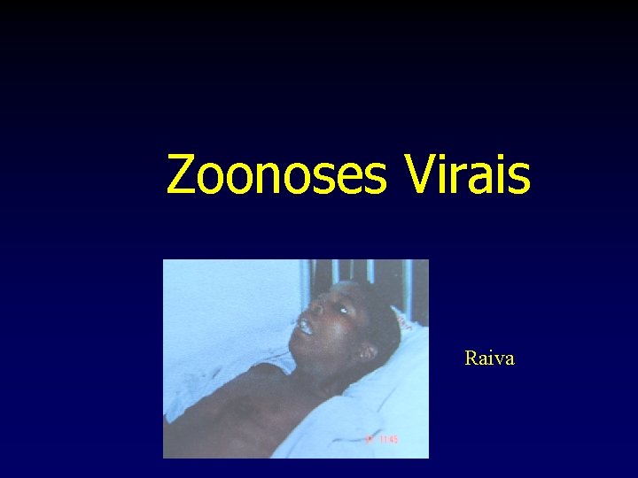 Zoonoses Virais Raiva 