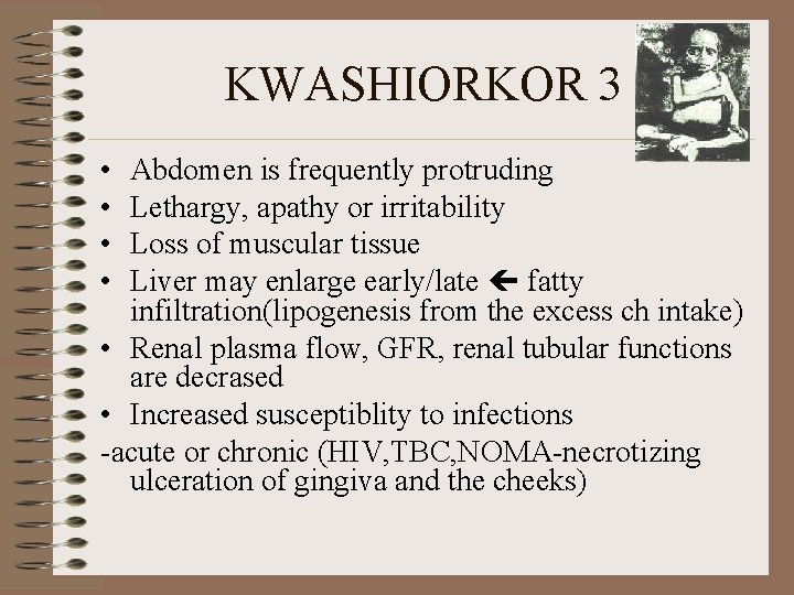 KWASHIORKOR 3 • • Abdomen is frequently protruding Lethargy, apathy or irritability Loss of