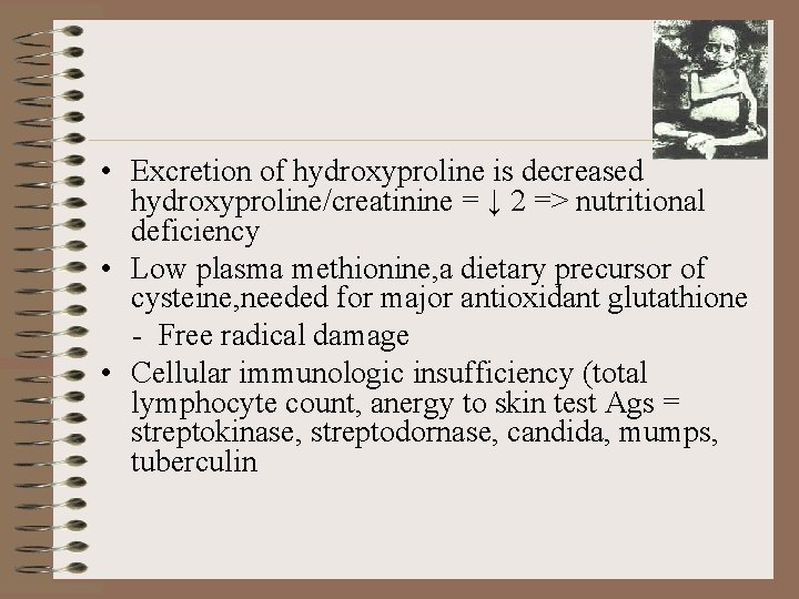  • Excretion of hydroxyproline is decreased hydroxyproline/creatinine = ↓ 2 => nutritional deficiency