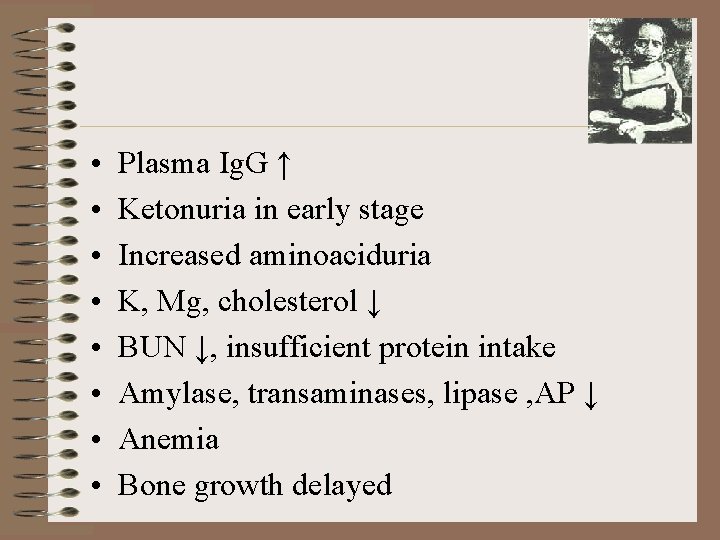  • • Plasma Ig. G ↑ Ketonuria in early stage Increased aminoaciduria K,