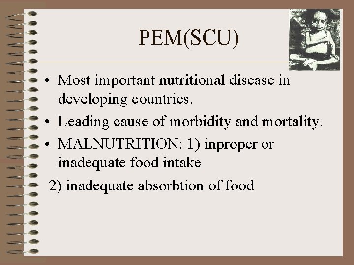 PEM(SCU) • Most important nutritional disease in developing countries. • Leading cause of morbidity