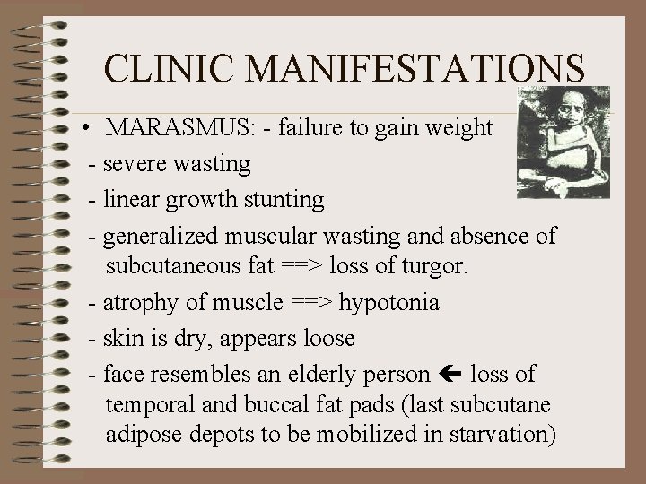 CLINIC MANIFESTATIONS • MARASMUS: - failure to gain weight - severe wasting - linear