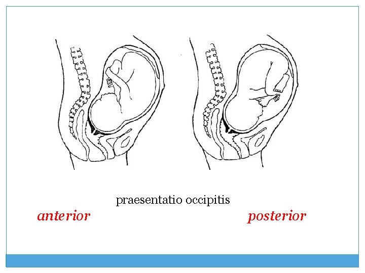 praesentatio occipitis anterior posterior 