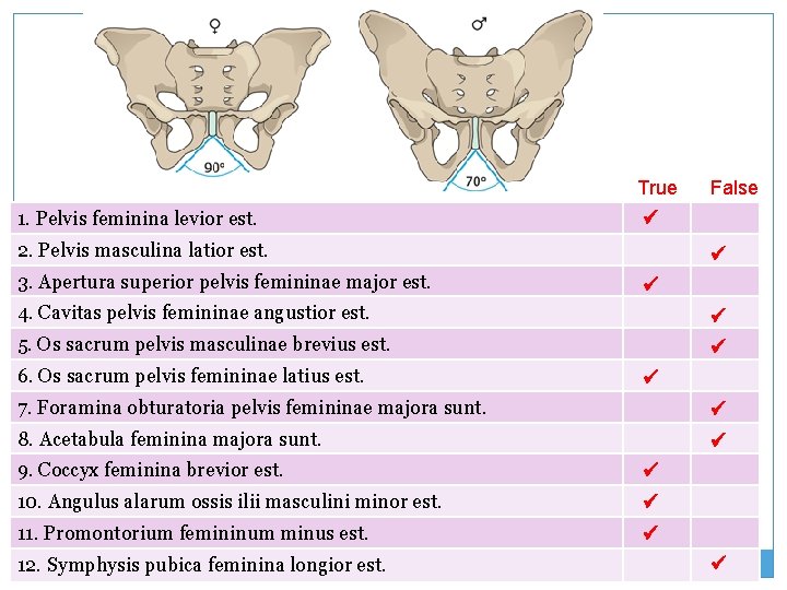 True 1. Pelvis feminina levior est. 2. Pelvis masculina latior est. 3. Apertura superior