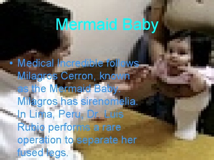 Mermaid Baby • Medical Incredible follows Milagros Cerron, known as the Mermaid Baby. Milagros