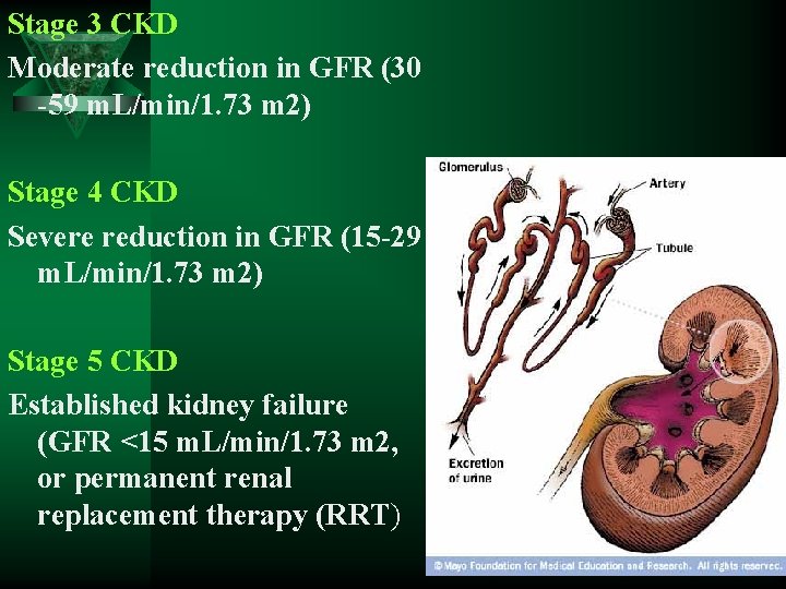 Stage 3 CKD Moderate reduction in GFR (30 -59 m. L/min/1. 73 m 2)