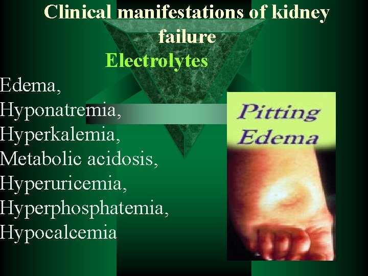 Clinical manifestations of kidney failure Electrolytes Edema, Hyponatremia, Hyperkalemia, Metabolic acidosis, Hyperuricemia, Hyperphosphatemia, Hypocalcemia