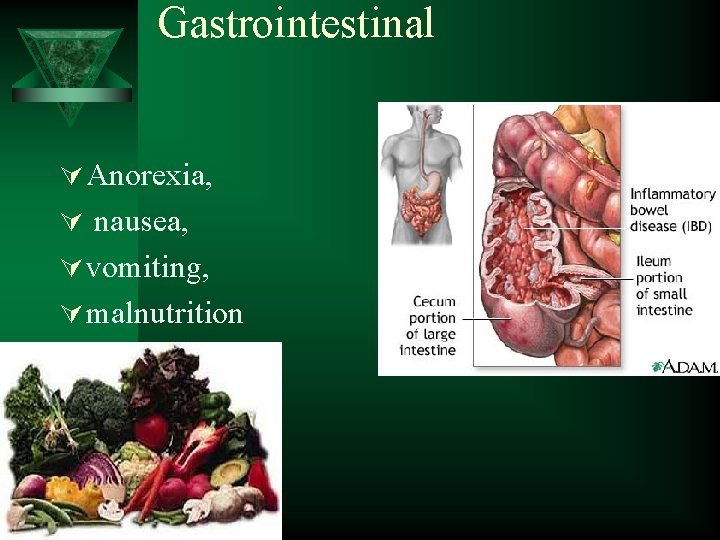Gastrointestinal Ú Anorexia, Ú nausea, Ú vomiting, Ú malnutrition 