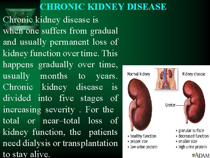 CHRONIC KIDNEY DISEASE Chronic kidney disease is when one suffers from gradual and usually