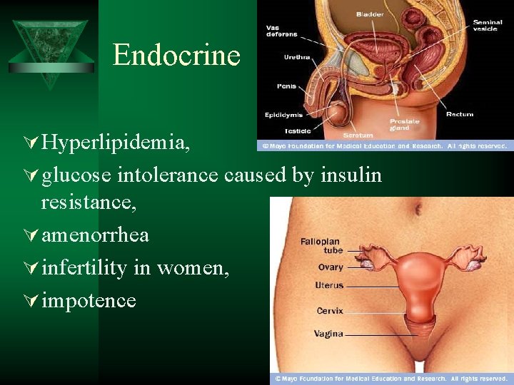 Endocrine Ú Hyperlipidemia, Ú glucose intolerance caused by insulin resistance, Ú amenorrhea Ú infertility