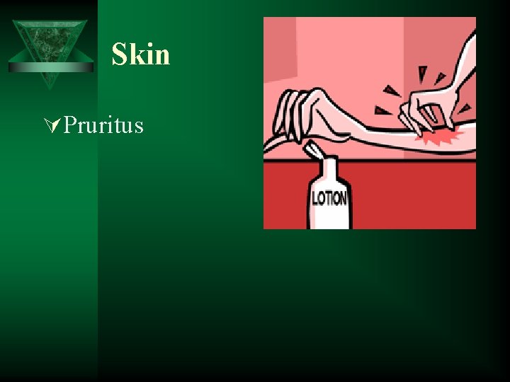 Skin ÚPruritus 