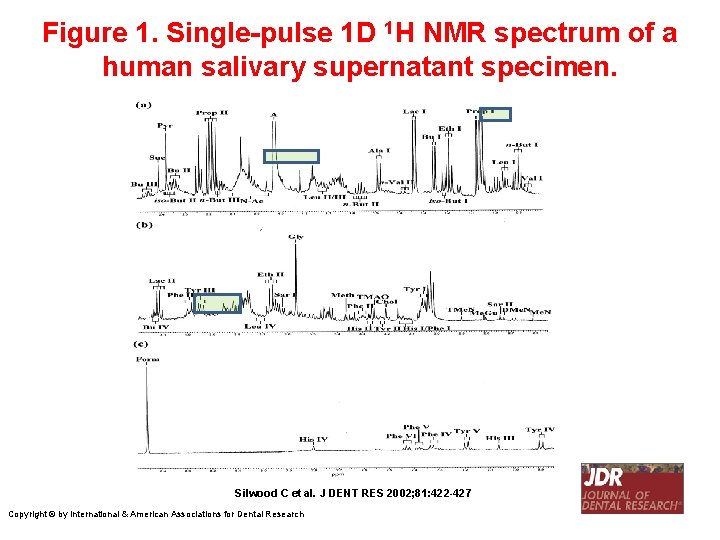 Figure 1. Single-pulse 1 D 1 H NMR spectrum of a human salivary supernatant