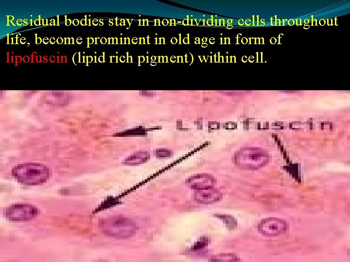 Residual bodies stay in non-dividing cells throughout life, become prominent in old age in