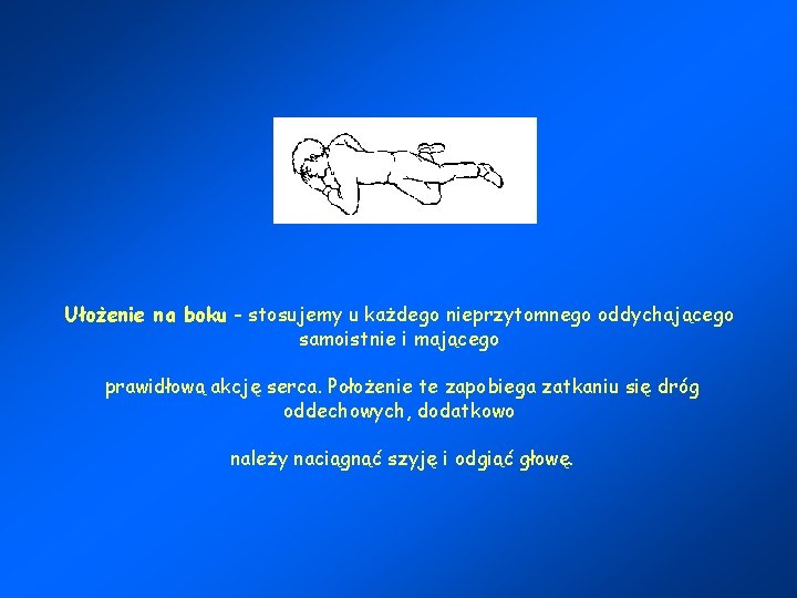 Ułożenie na boku - stosujemy u każdego nieprzytomnego oddychającego samoistnie i mającego prawidłową akcję