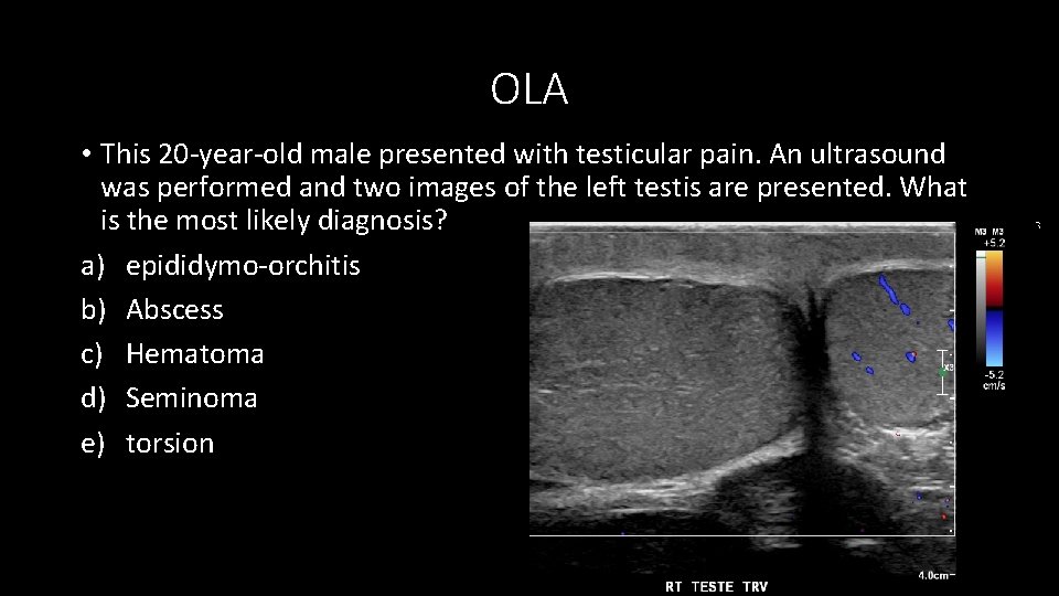 OLA • This 20 -year-old male presented with testicular pain. An ultrasound was performed