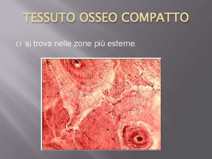 TESSUTO OSSEO COMPATTO � si trova nelle zone più esterne. 