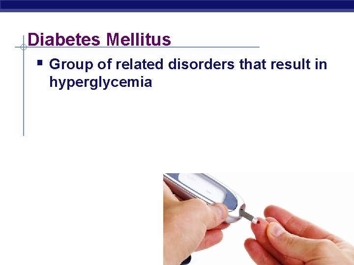 Diabetes Mellitus § Group of related disorders that result in hyperglycemia 
