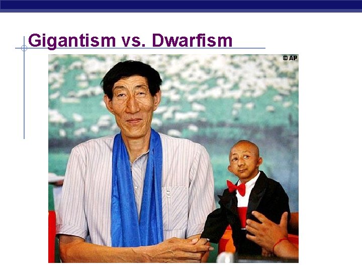 Gigantism vs. Dwarfism 