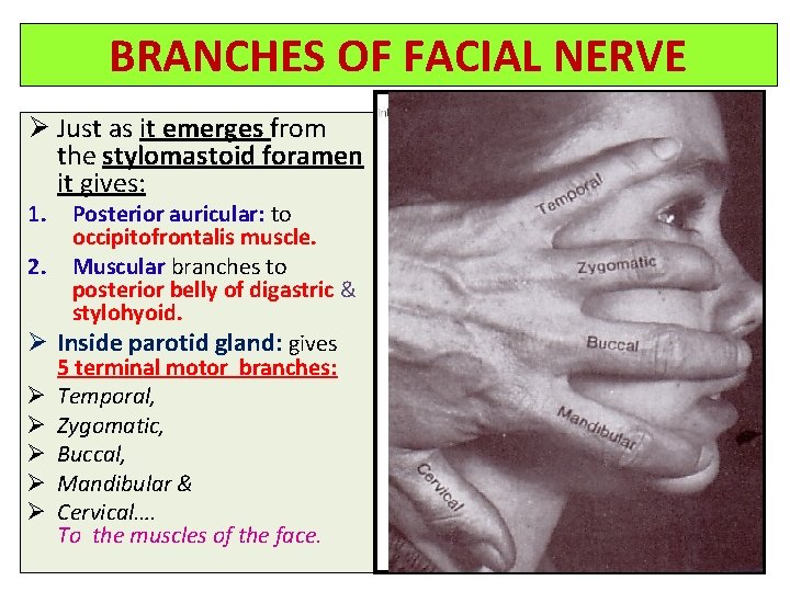 BRANCHES OF FACIAL NERVE Ø Just as it emerges from the stylomastoid foramen it
