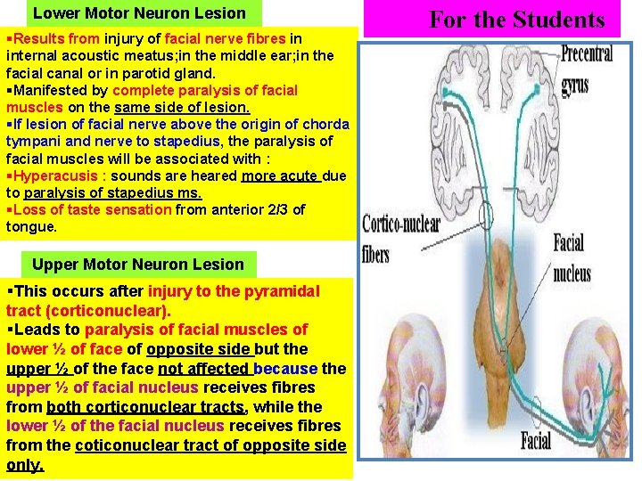 Lower Motor Neuron Lesion §Results from injury of facial nerve fibres in internal acoustic