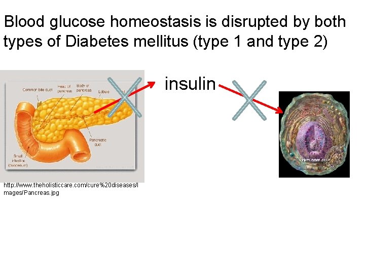 Blood glucose homeostasis is disrupted by both types of Diabetes mellitus (type 1 and