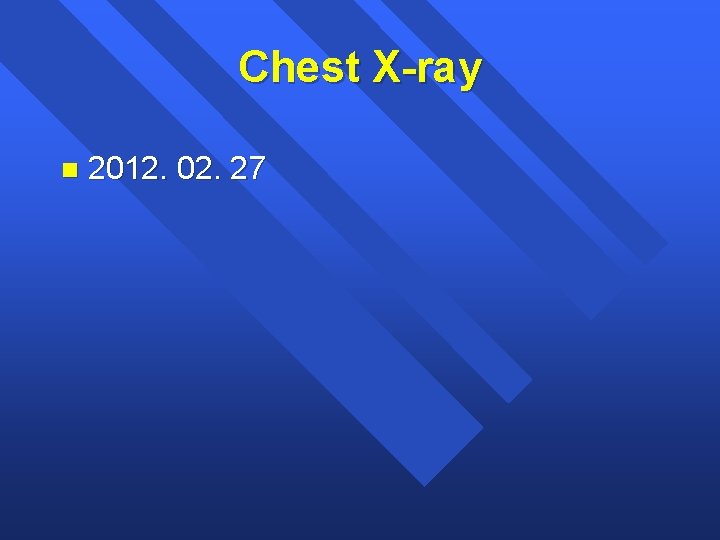 Chest X-ray n 2012. 02. 27 