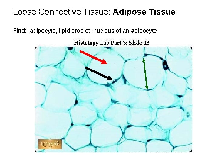 Loose Connective Tissue: Adipose Tissue Find: adipocyte, lipid droplet, nucleus of an adipocyte 