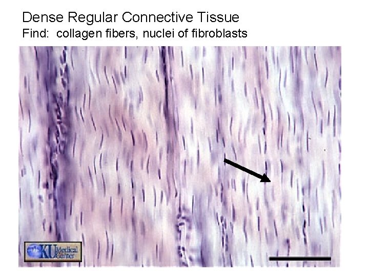 Dense Regular Connective Tissue Find: collagen fibers, nuclei of fibroblasts 