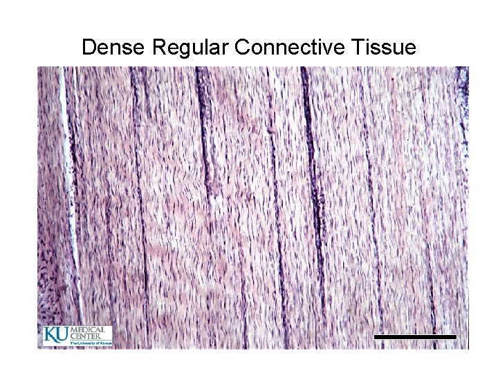 Dense Regular Connective Tissue 