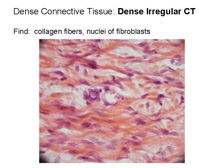 Dense Connective Tissue: Dense Irregular CT Find: collagen fibers, nuclei of fibroblasts 