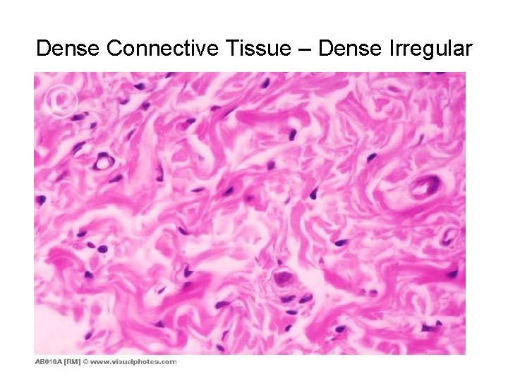 Dense Connective Tissue – Dense Irregular 