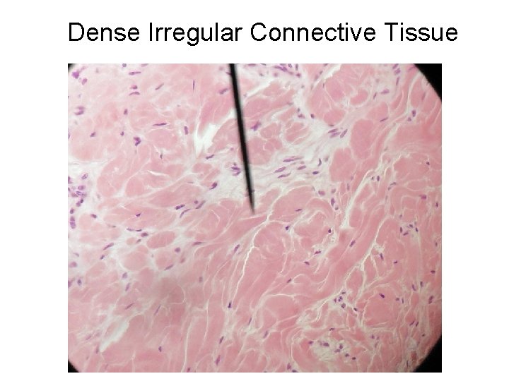Dense Irregular Connective Tissue 