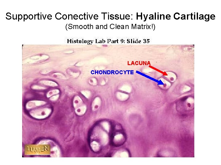 Supportive Conective Tissue: Hyaline Cartilage (Smooth and Clean Matrix!) LACUNA CHONDROCYTE 