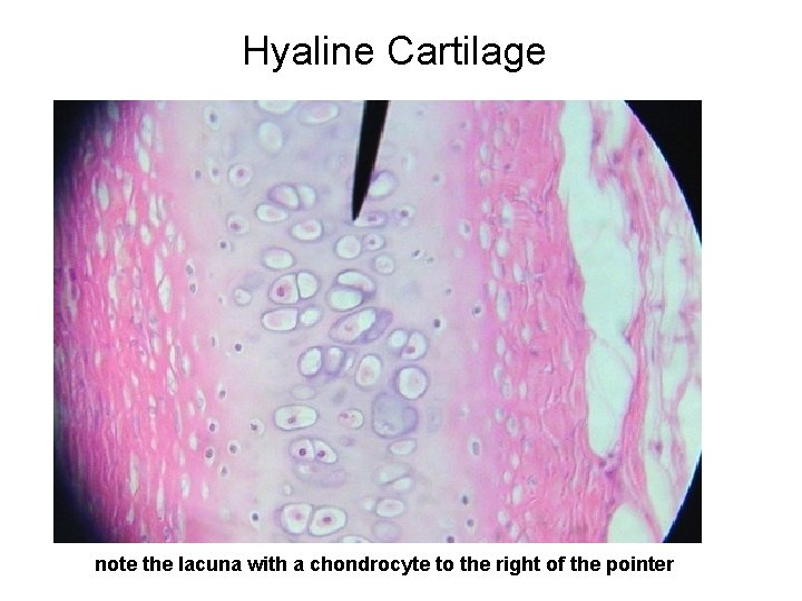 Hyaline Cartilage note the lacuna with a chondrocyte to the right of the pointer