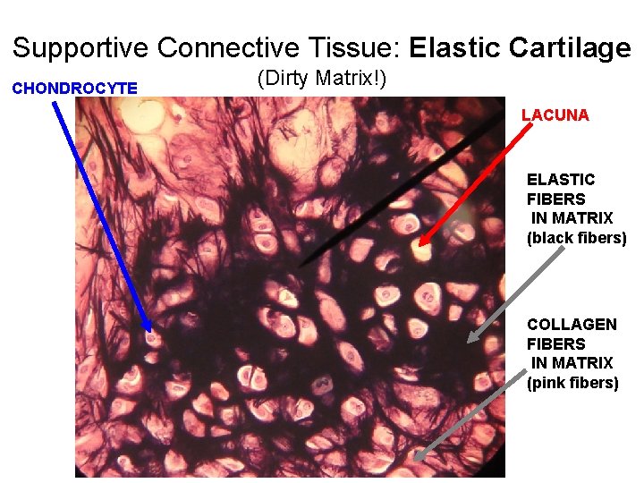 Supportive Connective Tissue: Elastic Cartilage CHONDROCYTE (Dirty Matrix!) LACUNA ELASTIC FIBERS IN MATRIX (black