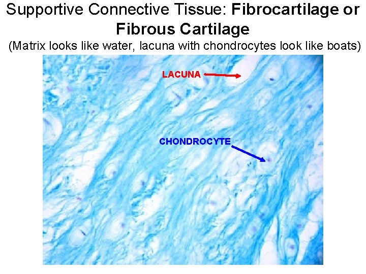 Supportive Connective Tissue: Fibrocartilage or Fibrous Cartilage (Matrix looks like water, lacuna with chondrocytes
