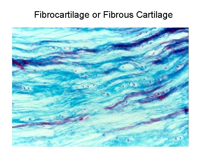 Fibrocartilage or Fibrous Cartilage 